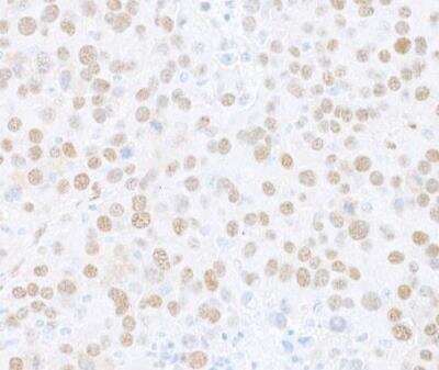 Immunohistochemistry-Paraffin: FOX2 Antibody [NB110-40588]