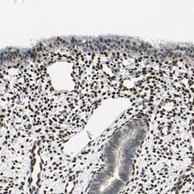 Immunohistochemistry-Paraffin: FOX2 Antibody [NBP1-91910]