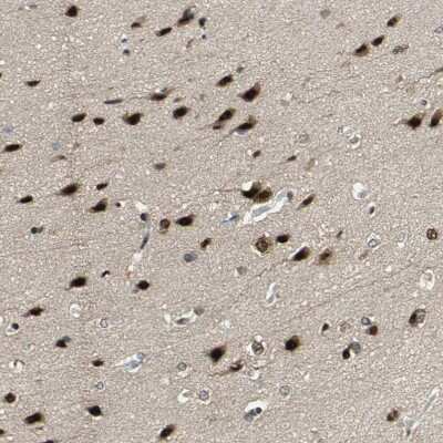 Immunohistochemistry-Paraffin: FOX2 Antibody [NBP1-91910]