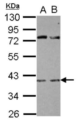 Western Blot: FOX2 Antibody [NBP2-16516]