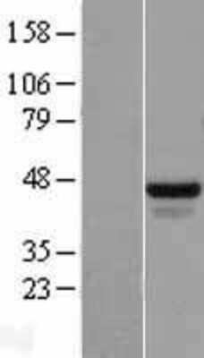 Western Blot: FOX2 Overexpression Lysate [NBL1-15218]