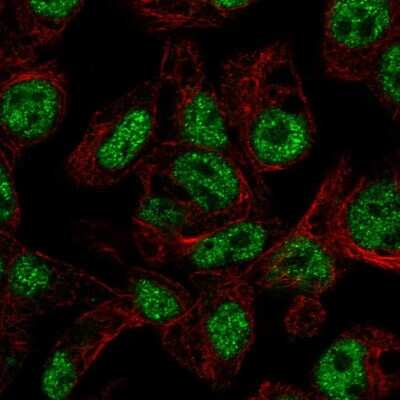 Immunocytochemistry/ Immunofluorescence: FOXA3 Antibody [NBP2-55686]