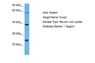 Western Blot: FOXA3 Antibody [NBP2-87462]