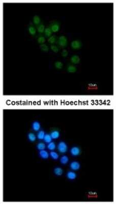Immunocytochemistry/ Immunofluorescence: FOXB1 Antibody [NBP2-16517]