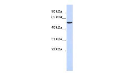 Western Blot: FOXD4 Antibody [NBP2-84026]
