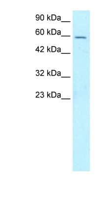 Western Blot: FOXG1 Antibody [NBP1-56594]