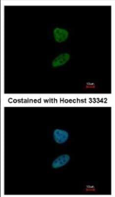 Immunocytochemistry/ Immunofluorescence: FOXI1 Antibody [NBP2-16518]
