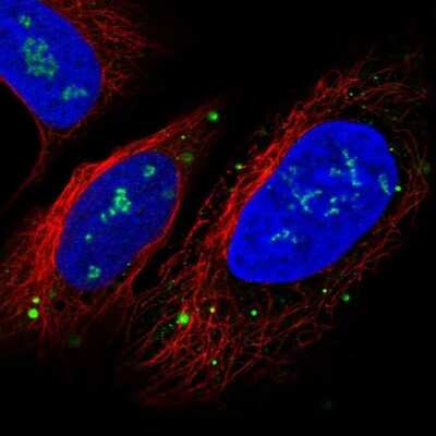 Immunocytochemistry/ Immunofluorescence: FOXI1 Antibody [NBP2-49660]