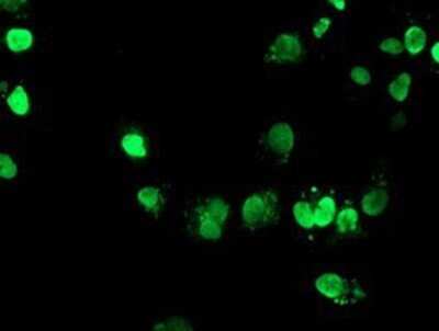 Immunocytochemistry/ Immunofluorescence: FOXI1 Antibody (OTI1D4) - Azide and BSA Free [NBP2-70747]