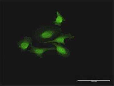 Immunocytochemistry/ Immunofluorescence: FOXJ2 Antibody [H00055810-D01P]