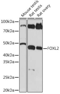 Western Blot: FOXL2 Antibody (4H5X3) [NBP3-16231]