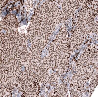 Immunohistochemistry-Paraffin: FOXL2 Antibody (CL12762) [NBP3-18544]