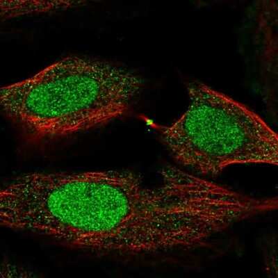 Immunocytochemistry/ Immunofluorescence: FOXL2 Antibody [NBP2-49608]