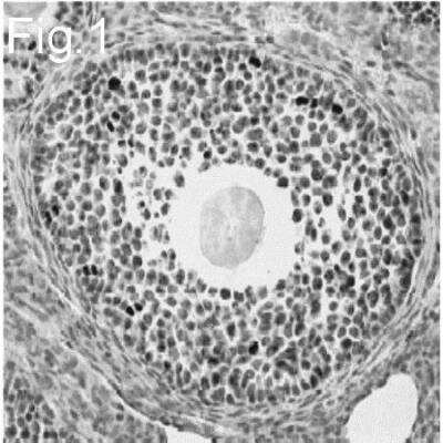 Immunohistochemistry-Paraffin: FOXL2 Antibody [NBP2-22473]