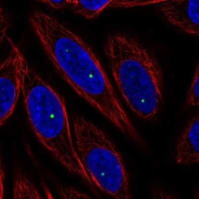 Immunocytochemistry/ Immunofluorescence: FOXL2NB Antibody [NBP2-57587]