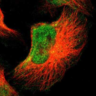 Immunocytochemistry/ Immunofluorescence: FOXN2 Antibody [NBP1-83153]