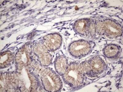 Immunohistochemistry: FOXO4 Antibody (OTI1A4) [NBP2-45712]