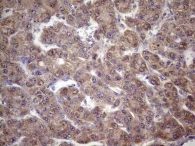 Immunohistochemistry: FOXO4 Antibody (OTI1A4) - Azide and BSA Free [NBP2-71198]