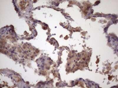 Immunohistochemistry: FOXO4 Antibody (OTI1A4) - Azide and BSA Free [NBP2-71198]