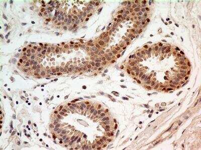 Immunohistochemistry-Paraffin: FoxP1 Antibody (JC12) - BSA Free [NB100-65125]