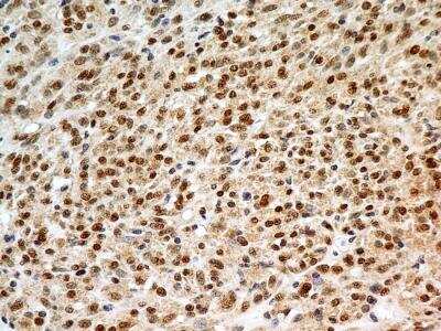 Immunohistochemistry-Paraffin: FoxP1 Antibody (JC12) - BSA Free [NB100-65125]