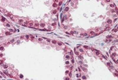 Immunohistochemistry-Paraffin: FoxP2 Antibody [NB100-55411]