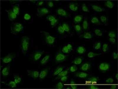 Immunocytochemistry/ Immunofluorescence: FOXR2 Antibody (2C1) [H00139628-M01]