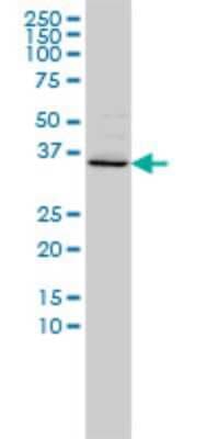 Western Blot: FOXR2 Antibody (2C1) [H00139628-M01]