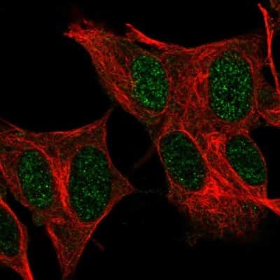 Immunocytochemistry/ Immunofluorescence: FOXR2 Antibody [NBP1-81870]