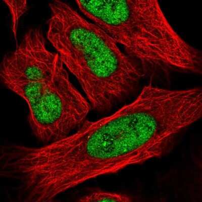 Immunocytochemistry/ Immunofluorescence: FOXR2 Antibody [NBP2-56756]