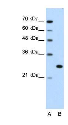 Western Blot: FOXR2 Antibody [NBP1-80511]