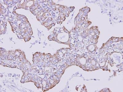 Immunohistochemistry-Paraffin: FOXRED1 Antibody [NBP1-31570]