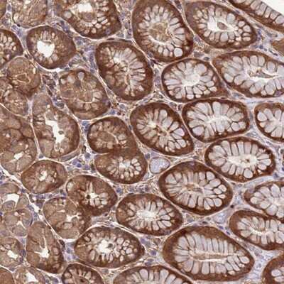 Immunohistochemistry-Paraffin: FOXRED1 Antibody [NBP2-14025]