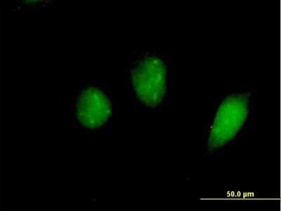 Immunocytochemistry/ Immunofluorescence: FOXS1 Antibody [H00002307-B01P]