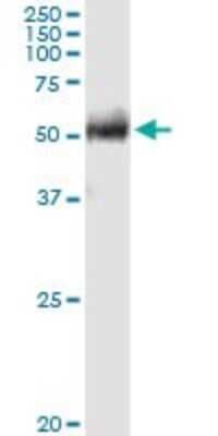 Western Blot: FPGT Antibody [H00008790-D01P]