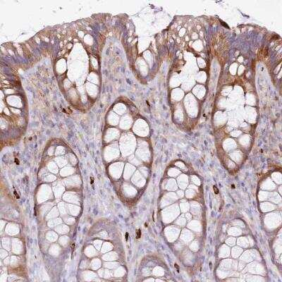 Immunohistochemistry-Paraffin: FPR1 Antibody [NBP2-47452]