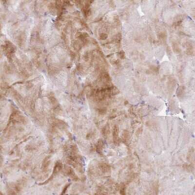 Immunohistochemistry-Paraffin: FPR1 Antibody [NBP2-47452]