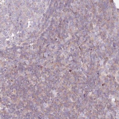 Immunohistochemistry-Paraffin: FPR1 Antibody [NBP2-47452]