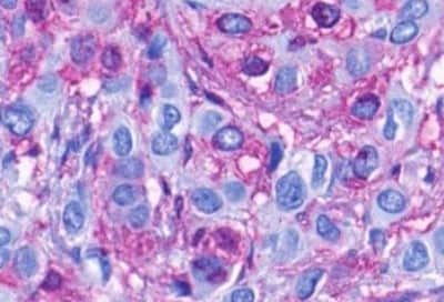 Immunohistochemistry: FPRL1/FPR2 Antibody [NBP3-14323]