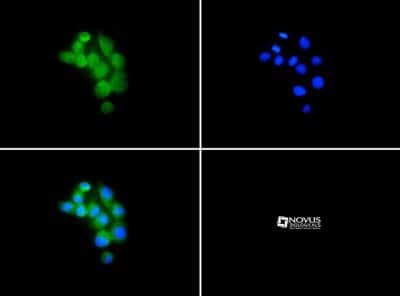 Immunocytochemistry/ Immunofluorescence: FPRL1/FPR2 Antibody - BSA Free [NLS1878]