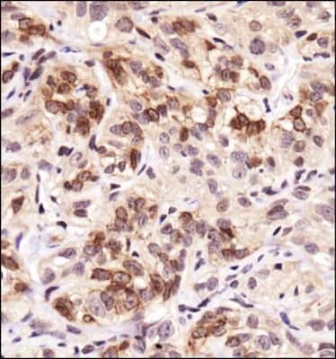 Immunohistochemistry: FPRL1/FPR2 Antibody - BSA Free [NLS1878]