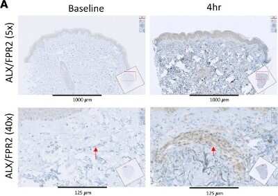 Immunohistochemistry-Paraffin: FPRL1/FPR2 Antibody - BSA Free [NLS1878]