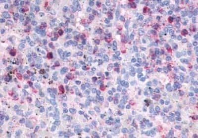 Immunohistochemistry-Paraffin: FPRL1/FPR2 Antibody [NBP3-14323]
