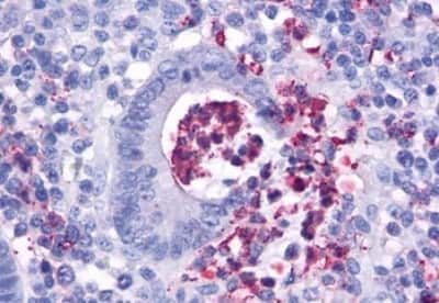 Immunohistochemistry-Paraffin: FPRL1/FPR2 Antibody [NBP3-14323]
