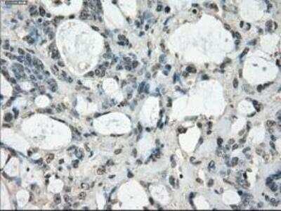 Immunohistochemistry-Paraffin: FRA-1/FOSL1 Antibody (OTI12F9) [NBP1-47757]