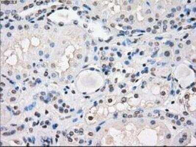 Immunohistochemistry-Paraffin: FRA-1/FOSL1 Antibody (OTI12F9) [NBP1-47757]