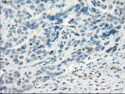 Immunohistochemistry-Paraffin: FRA-1/FOSL1 Antibody (OTI12F9) [NBP1-47757]