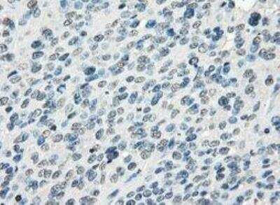 Immunohistochemistry-Paraffin: FRA-1/FOSL1 Antibody (OTI12F9) [NBP1-47757]