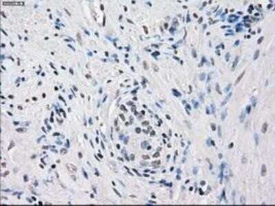 Immunohistochemistry: FRA-1/FOSL1 Antibody (OTI12F9) - Azide and BSA Free [NBP2-71351]