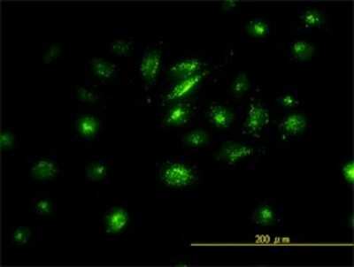 Immunocytochemistry/ Immunofluorescence: FRA2 Antibody (2B4-1C2) [H00002355-M01]